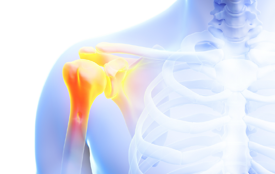 비수술 세포 재생 치료 우선